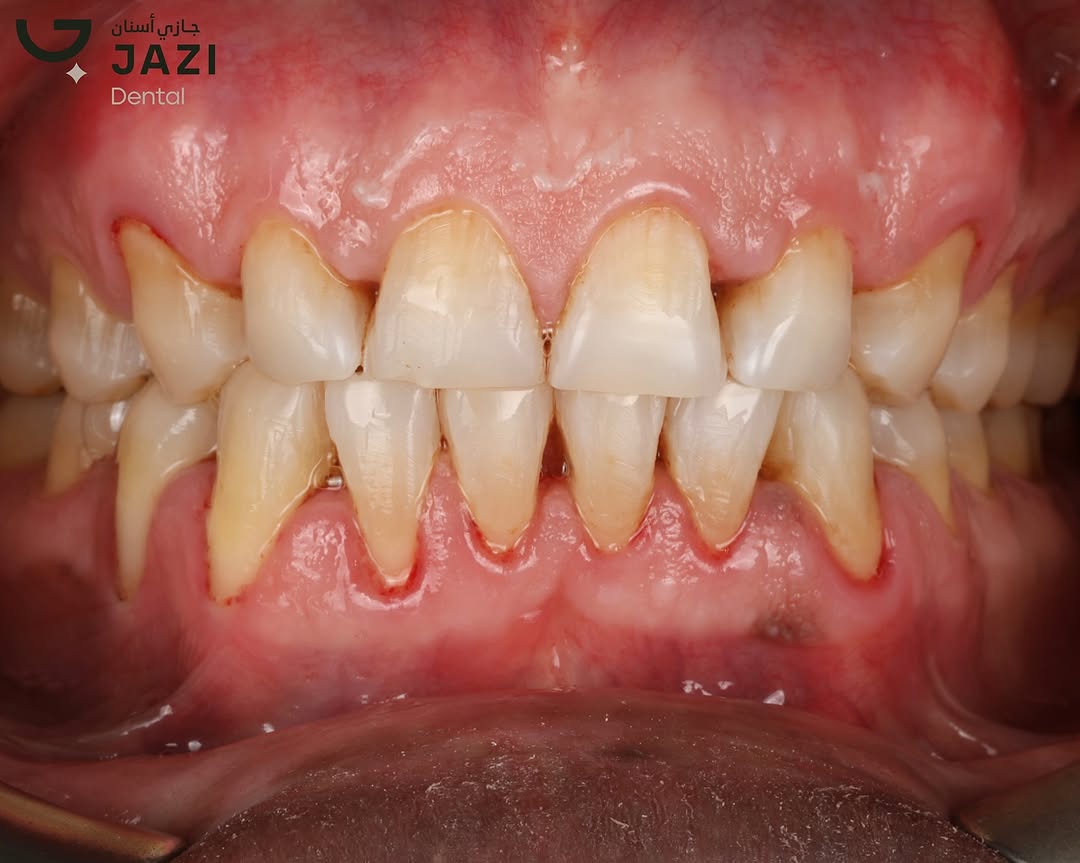 حالة بعد العلاج ٢